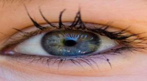 Dennie-Morgan-Falte: Allergieneigung an den Augen ablesen?